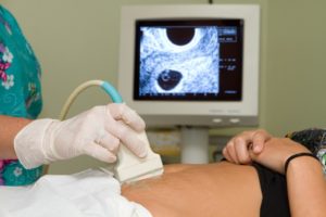 Ultraschall in der Schwangerschaft: Wie oft?