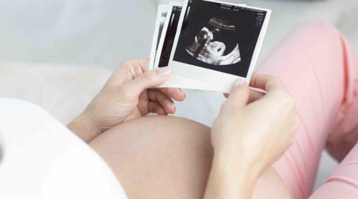 Geburtsmethoden - Zu Wassergeburt, Kaiserschnitt und co.