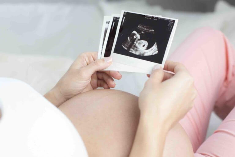 Geburtsmethoden - Zu Wassergeburt, Kaiserschnitt und co.