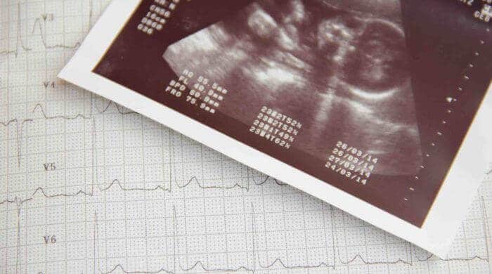 Entwicklung des Babys in den ersten 20. Wochen - Die erste Hälfte der Schwangerschaft