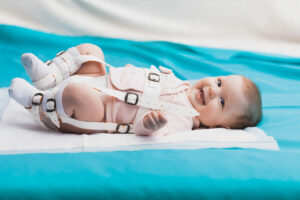 Tübinger Schiene – Hüftdysplasie erfolgreich behandeln